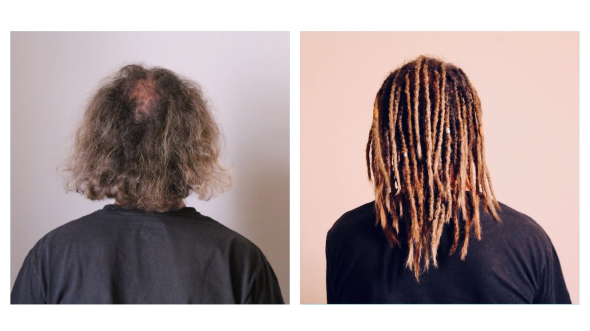 No or little hair? Dreads are possible!